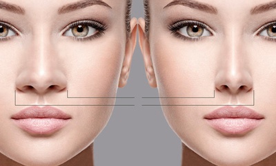 AESTHETIC NOSE SURGERY(RHINOPLASTY)