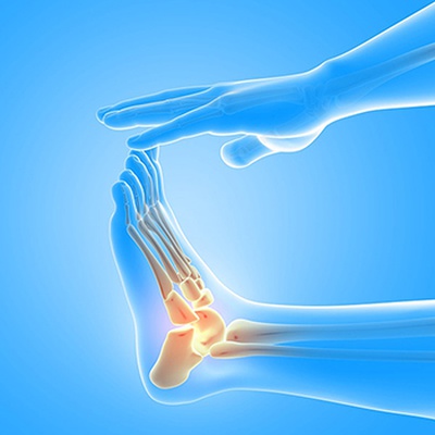 MORTON NEUROMA