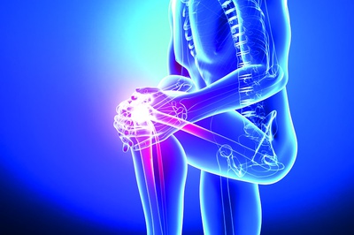 ARTHRITIS OF THE KNEE