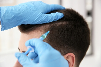 HAIR TRANSPLANTATION