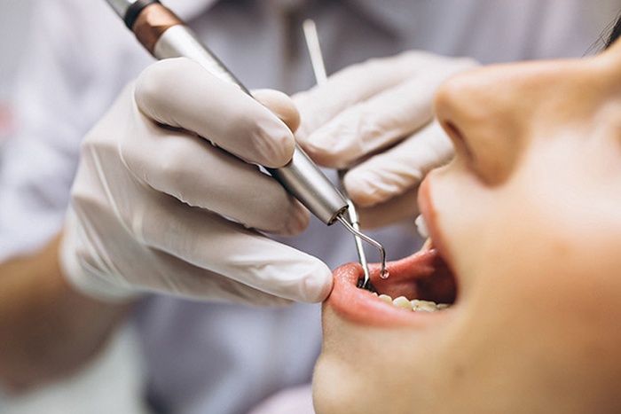 DENTAL FILLING