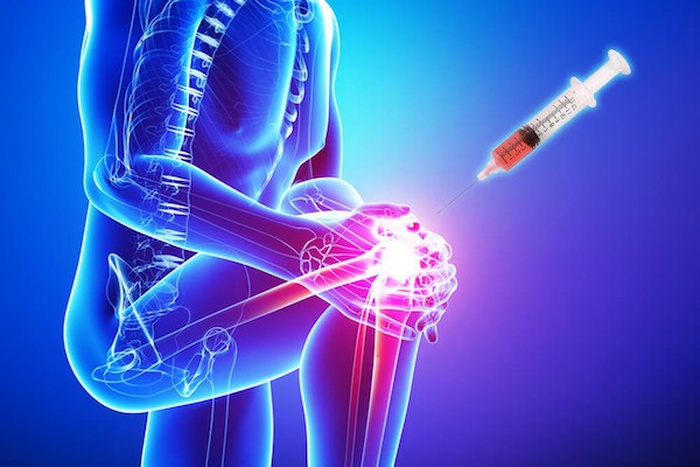 PLATELET-RICH PLASMA (PRP)