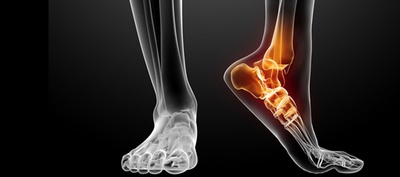 ARTICULAR CARTILAGE RESTORATION
